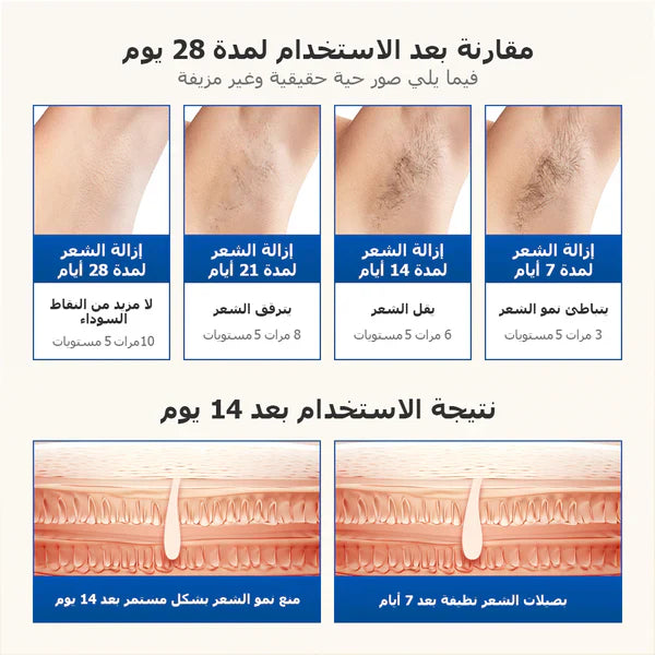 جهاز إزالة الشعر بالليزر المنزلي الأزرق KinseiBeautyT16 (5*العدسات) - Kinseibeauty | متجر على الإنترنت