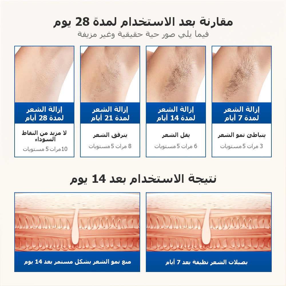 جهاز إزالة الشعر بالليزر المنزلي الأزرق KinseiBeautyT16 (2*العدسات) - Kinseibeauty | متجر على الإنترنت
