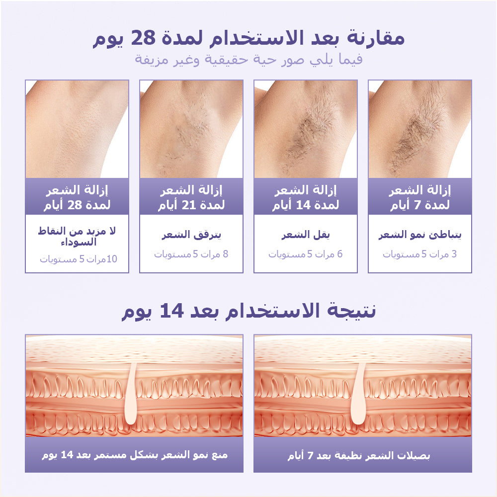 جهاز إزالة الشعر بالليزر المنزلي الأرجوانيKinseiBeauty T16 (4*العدسات) - Kinseibeauty | متجر على الإنترنت