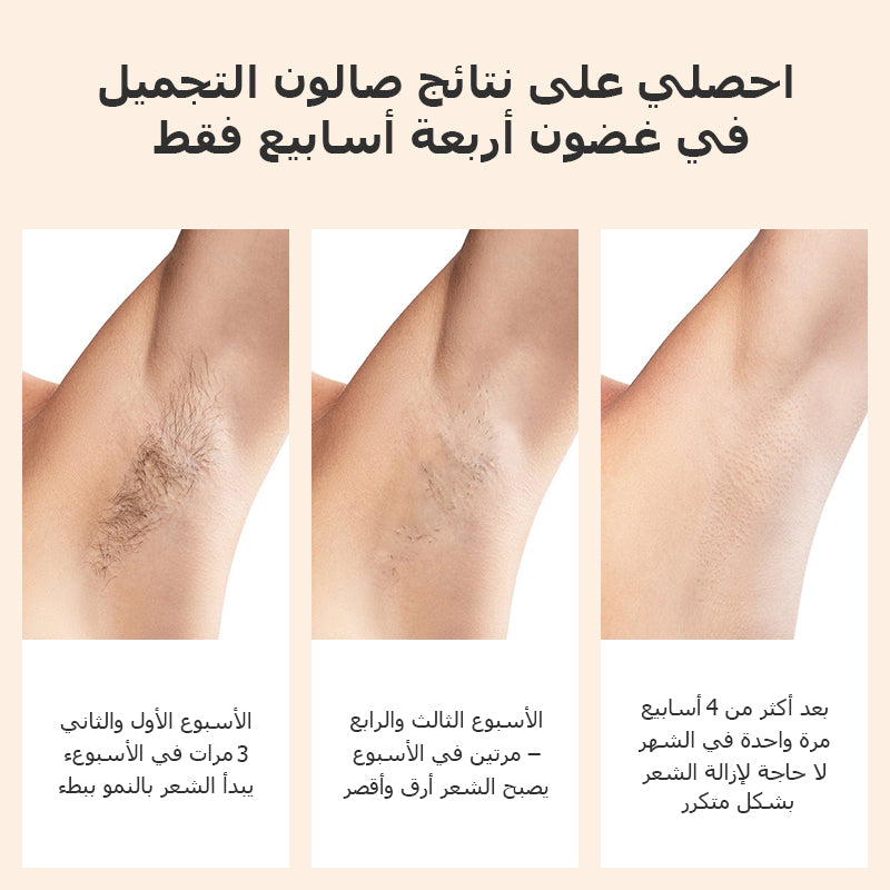 جهاز KinseiBeauty E3 لإزالة الشعر بالليزر المنزلي مع 1 عدسة قابلة للتبديل | 1 مليون ومضة ليزر